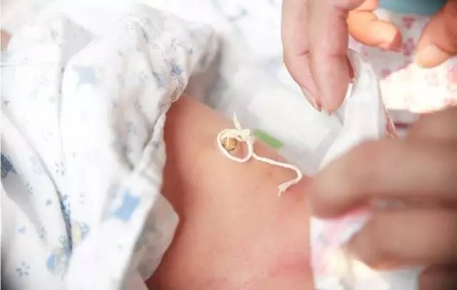 新生儿脐带护理之四步骤与护理液使用指南