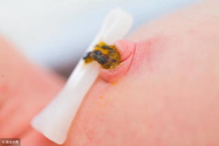 新生儿脐带护理你真的学会了吗?4大注意事项,新手爸妈请收藏